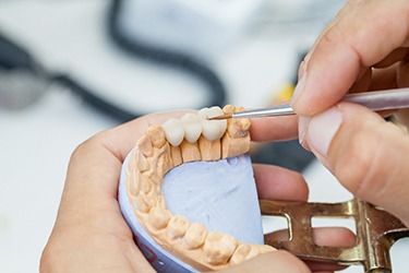 Dental lab technician working on dental bridge