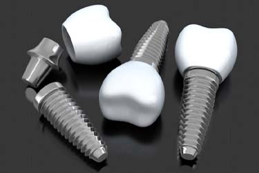 Dental implants in Schenectady on dark background