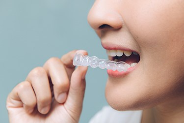 woman putting in her invisalign