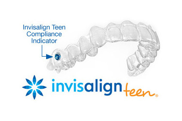 Invisalign Teen logo and animated aligner