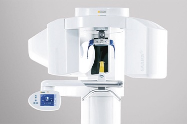 3D Cone Beam Scanner