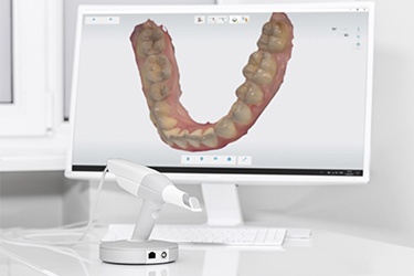 Intraoral Cameras