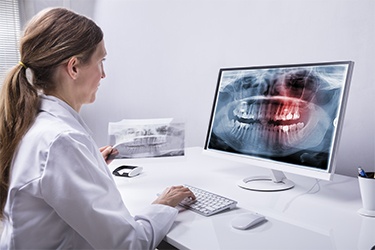 What to Expect from a Cone Beam Scan