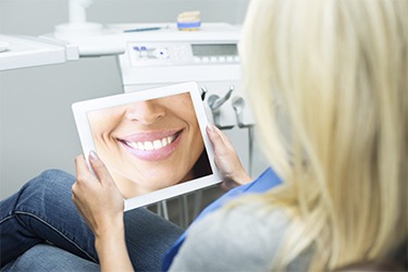 Free Invisalign Smile Simulation