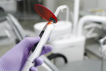 How Dental Sealants Are Applied