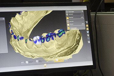 tooth scan