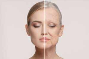 Before and after representation of aging process 