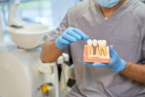 Dental professional holding dental implant model